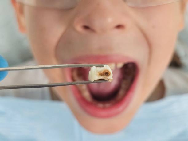 Best Emergency Treatment for Jaw Pain or Injury in Tokeneke, CT